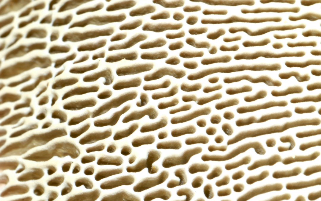 OSTEOPOROSIS: EL ERROR QUE DEBILITA TUS HUESOS (Y COMO EVITARLO EN MAGDALA SPORT CUENCA)