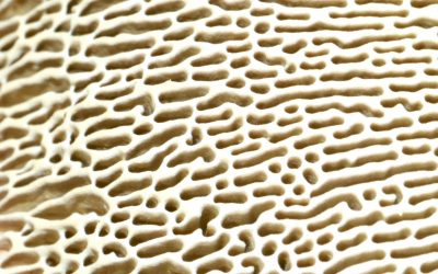 OSTEOPOROSIS: EL ERROR QUE DEBILITA TUS HUESOS (Y COMO EVITARLO EN MAGDALA SPORT CUENCA)